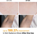 Dr. Melaxin Peel Shot Exfoliating Kojic Acid Turmeric Spray