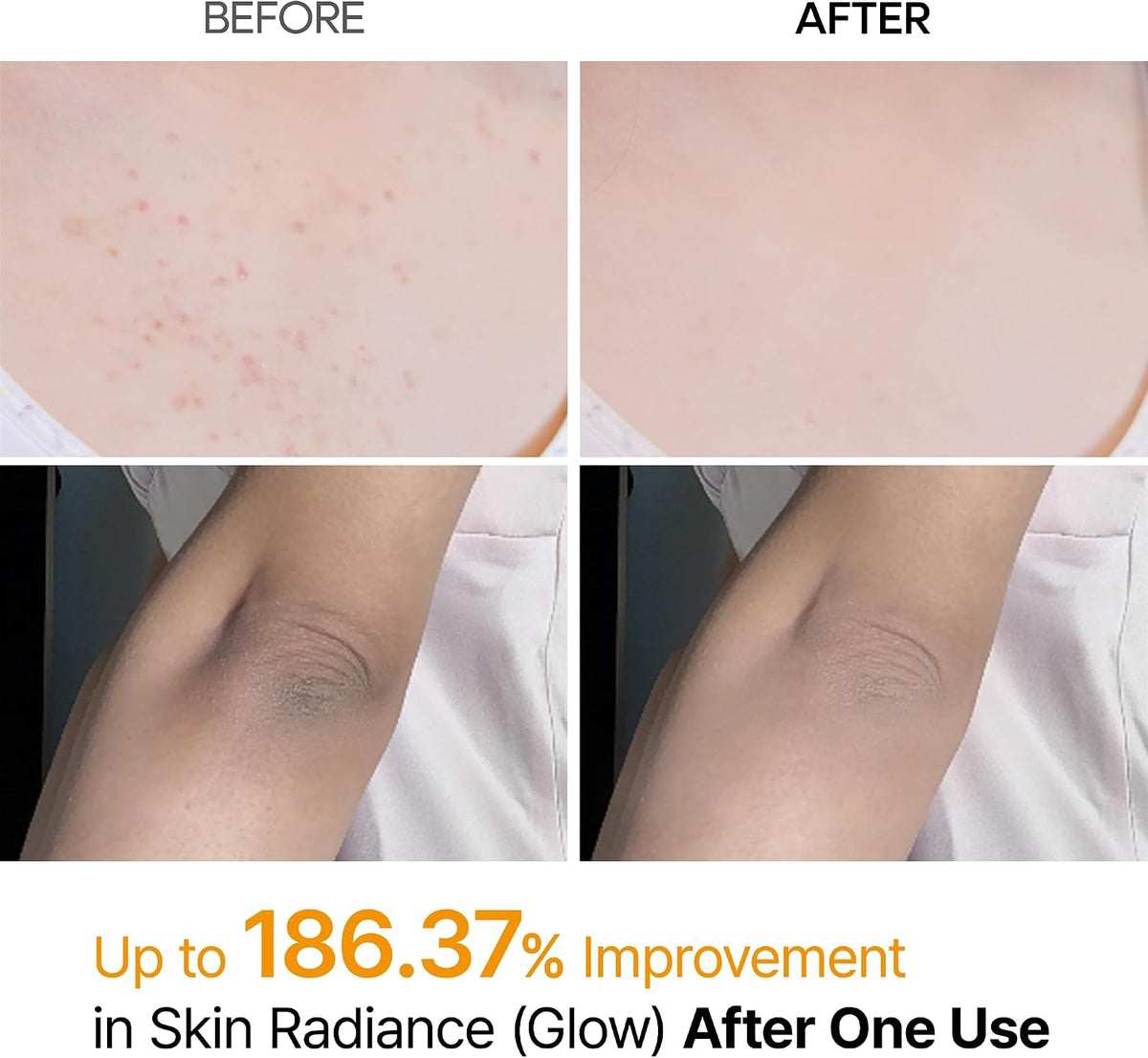 Dr. Melaxin Peel Shot Exfoliating Kojic Acid Turmeric Spray