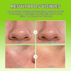 Dr. Melaxin Cactox Pore Relief Multi Balm