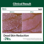 Dr.G Brightening Peeling Gel