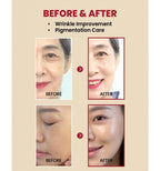 KSECRET SEOUL 1988 Serum: Retinal