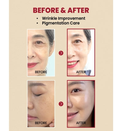 KSECRET SEOUL 1988 Serum: Retinal